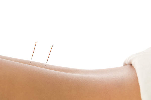 acupuncture sage femme paris