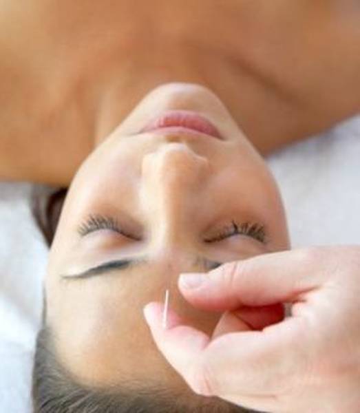 acupuncture urticaire chronique