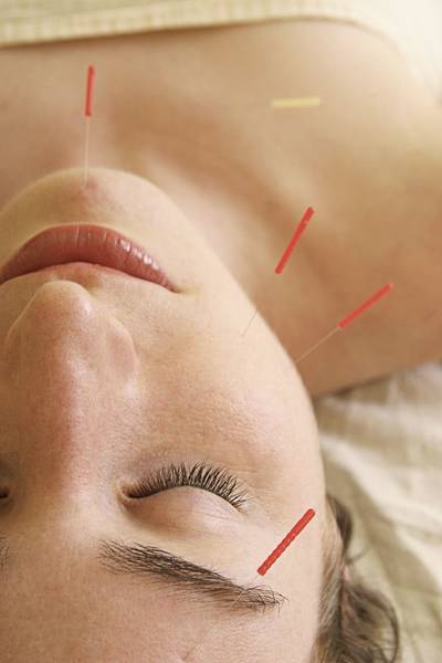 acupuncture evry acupuncture evry