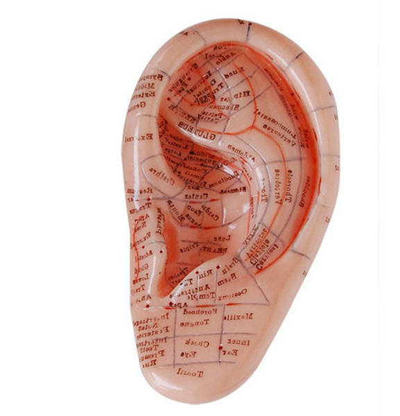 acupuncture traduction