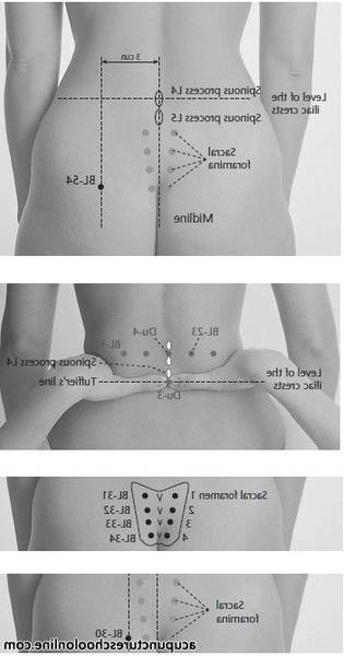 acupuncture upper east side