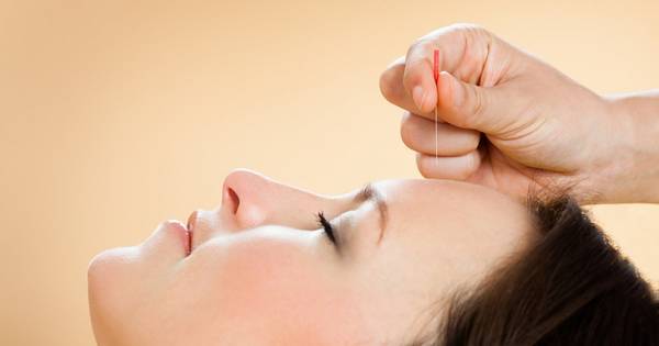 acupuncture yin yang