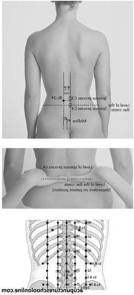 acupuncture rozay en brie