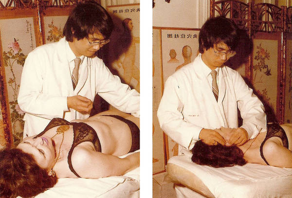 avis acupuncture maturation du col avis acupuncture maturation du col