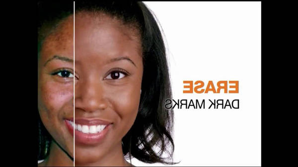 comment enlever les taches d acné