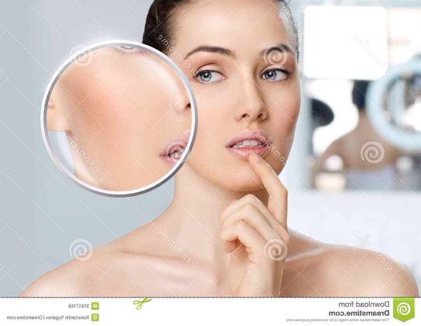 acné comment en finir