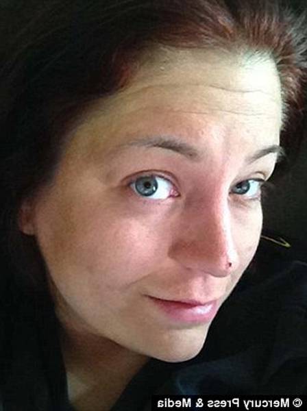 combien de temps acne du nourrisson