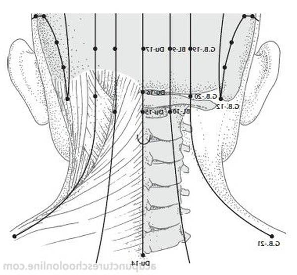 acupuncture mal de dos