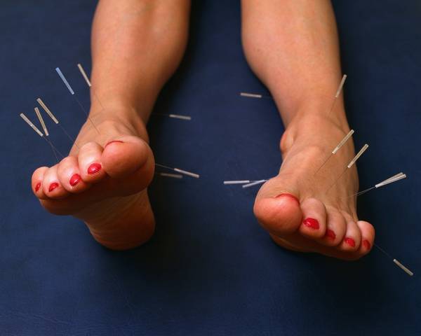 acupuncture villiers sur marne