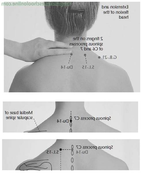 acupuncture esthétique