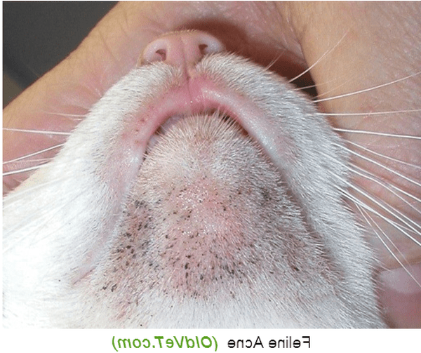 comment faire partir acné