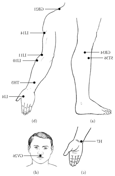 acupuncture les lilas
