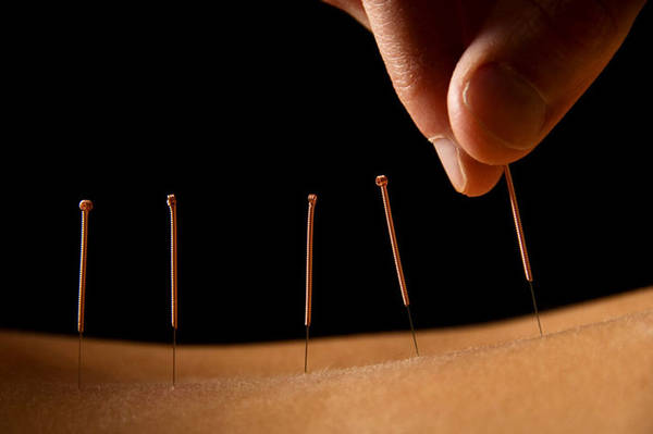 acupuncteur gradignan avis