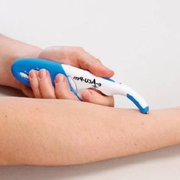 acupuncture traditionnelle chinoise