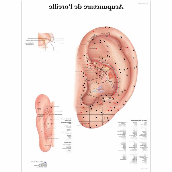 acupuncture perte de poids