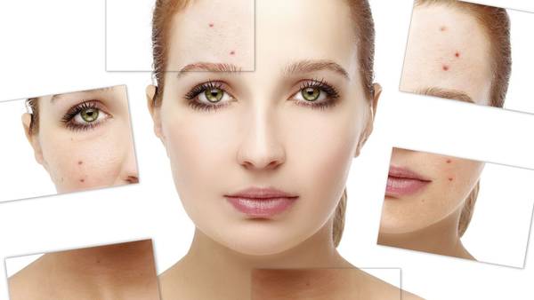 comment soigner l acné par le magnétisme