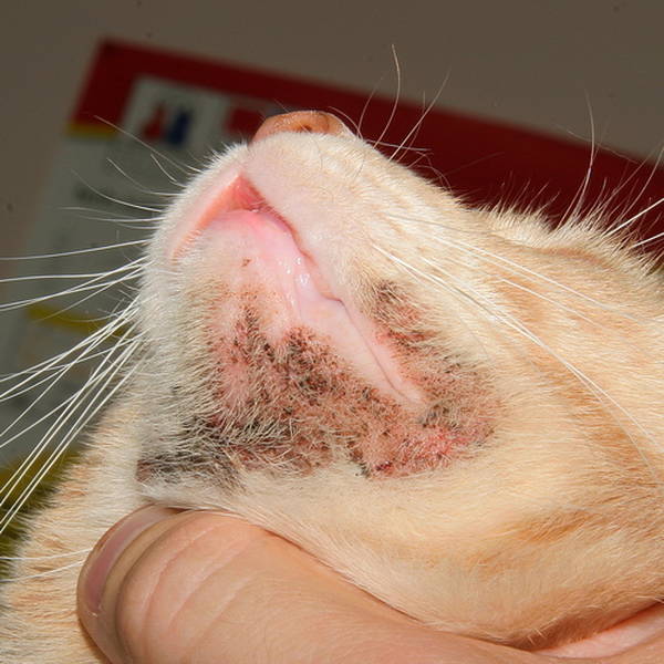 gattilier ou sauge acne hormonale