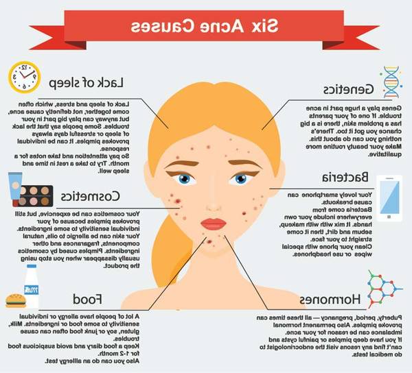 comment percer bouton blanc acne