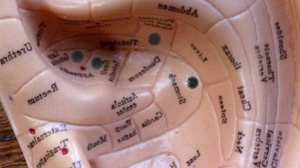 acupuncture avis stress