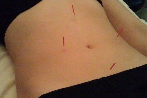 acupuncteur blois avis