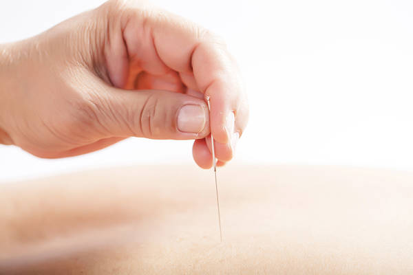 acupuncture infirmier