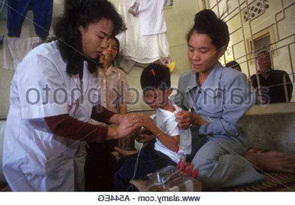 acupuncture xi cleft points