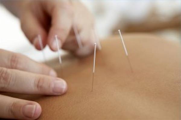 acupuncteur haguenau avis