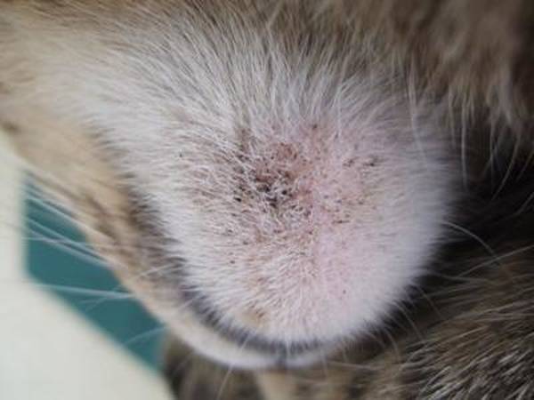 comment arreter l acné