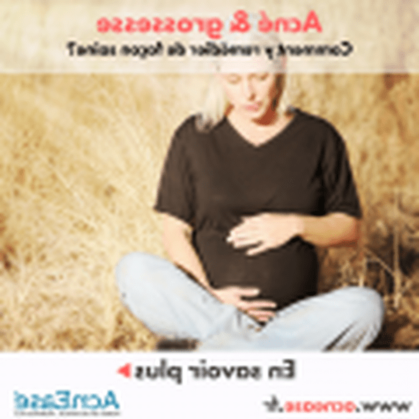 comment limiter les boutons d acné