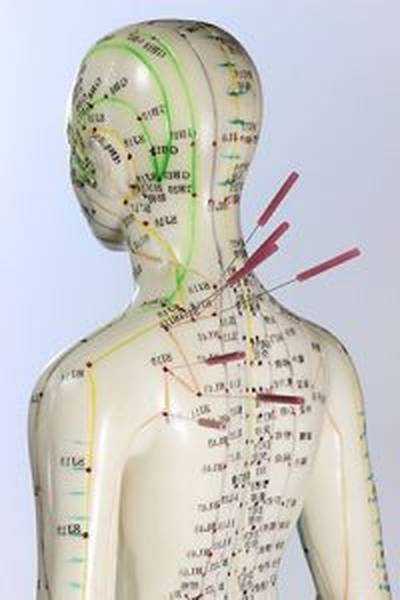 acupuncture cellulite avis