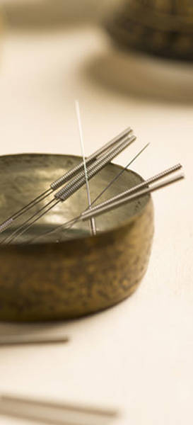 avis acupuncture accouchement