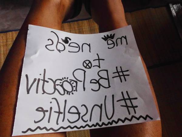 comment soigner l acné rosacée