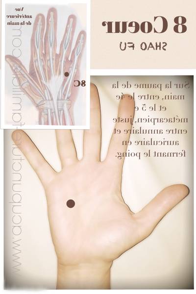 acupuncture tendinite paris