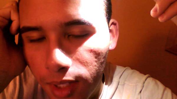 bouton d acné qui gratte