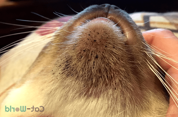 comment en finir avec son acné