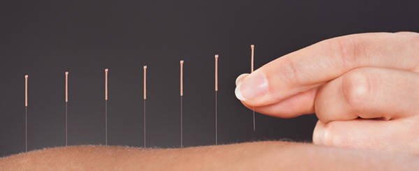 acupuncture quimperlé