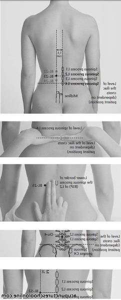 electro acupuncture avis