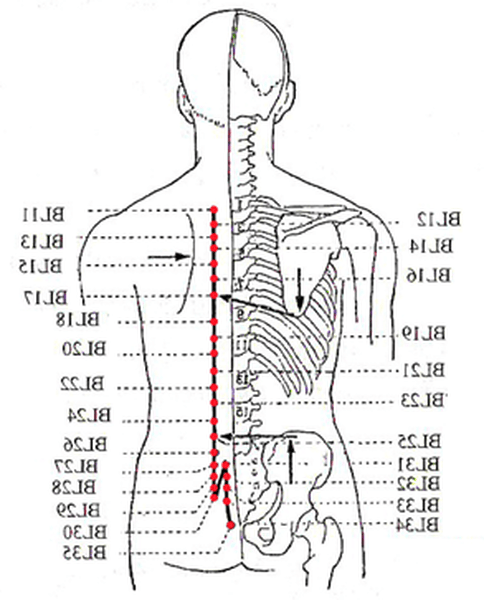 acupuncture et migraine