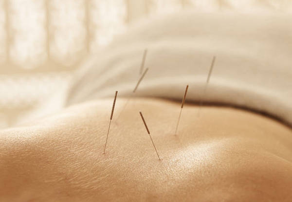 acupuncture quettehou