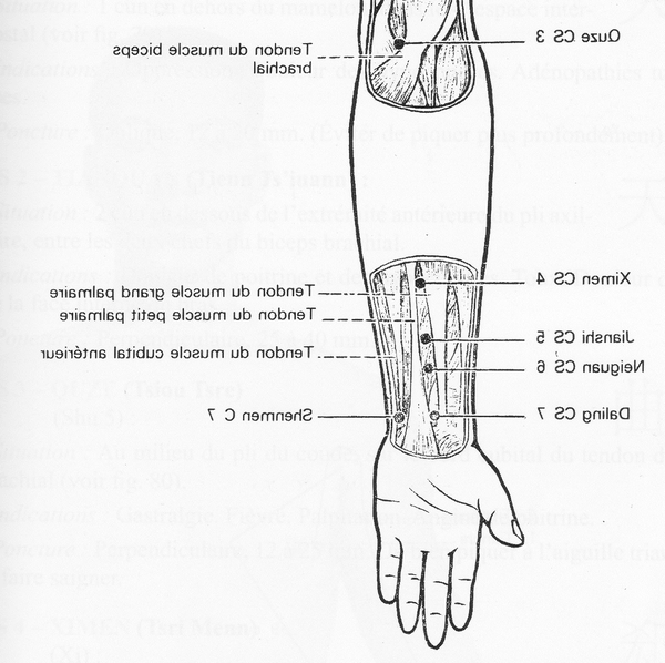 acupuncture wasquehal