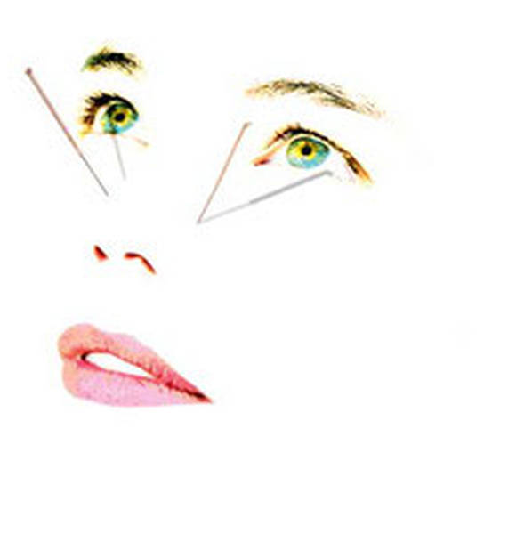 acupuncture traitement