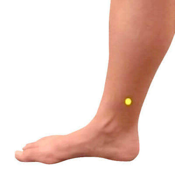 acupuncteur avis essonne