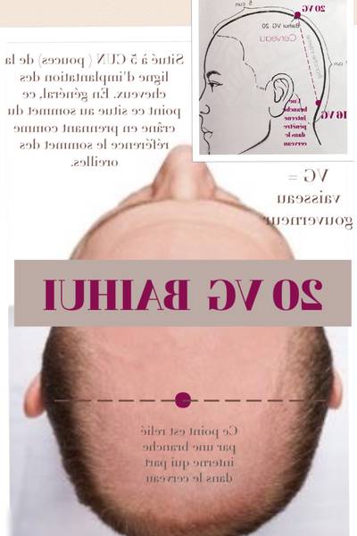 acupuncture asthme avis