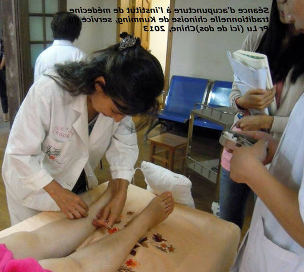 acupuncture zona intercostal