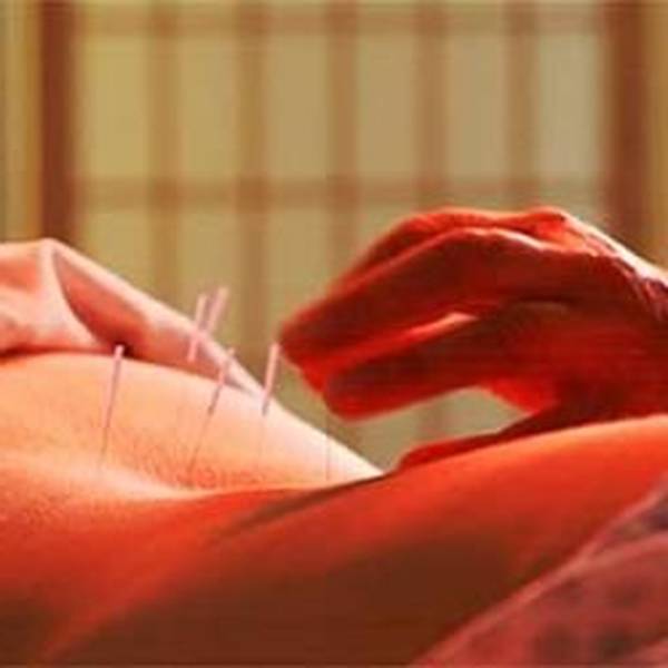 acupuncture regime