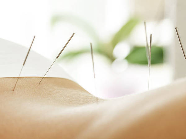 acupuncture zagreb