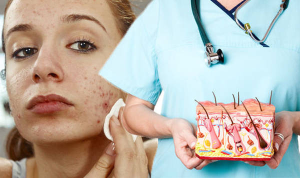 acne qui ne sort pas