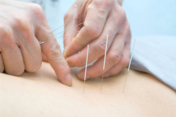 acupuncteur antibes avis