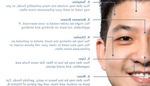 comment guérir une acné severe