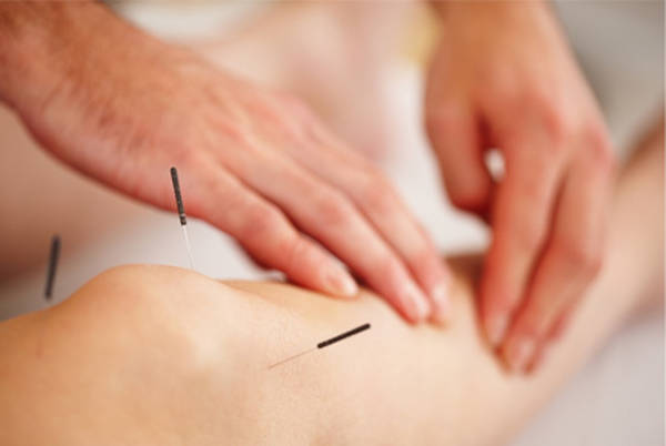 acupuncture quartier chinois